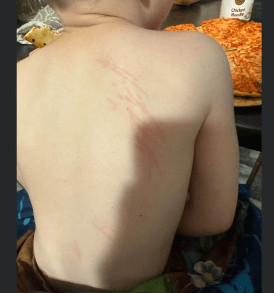 Illinois: Huntley Parents Discuss Reported Bullying and Playground Conflicts Involving Children